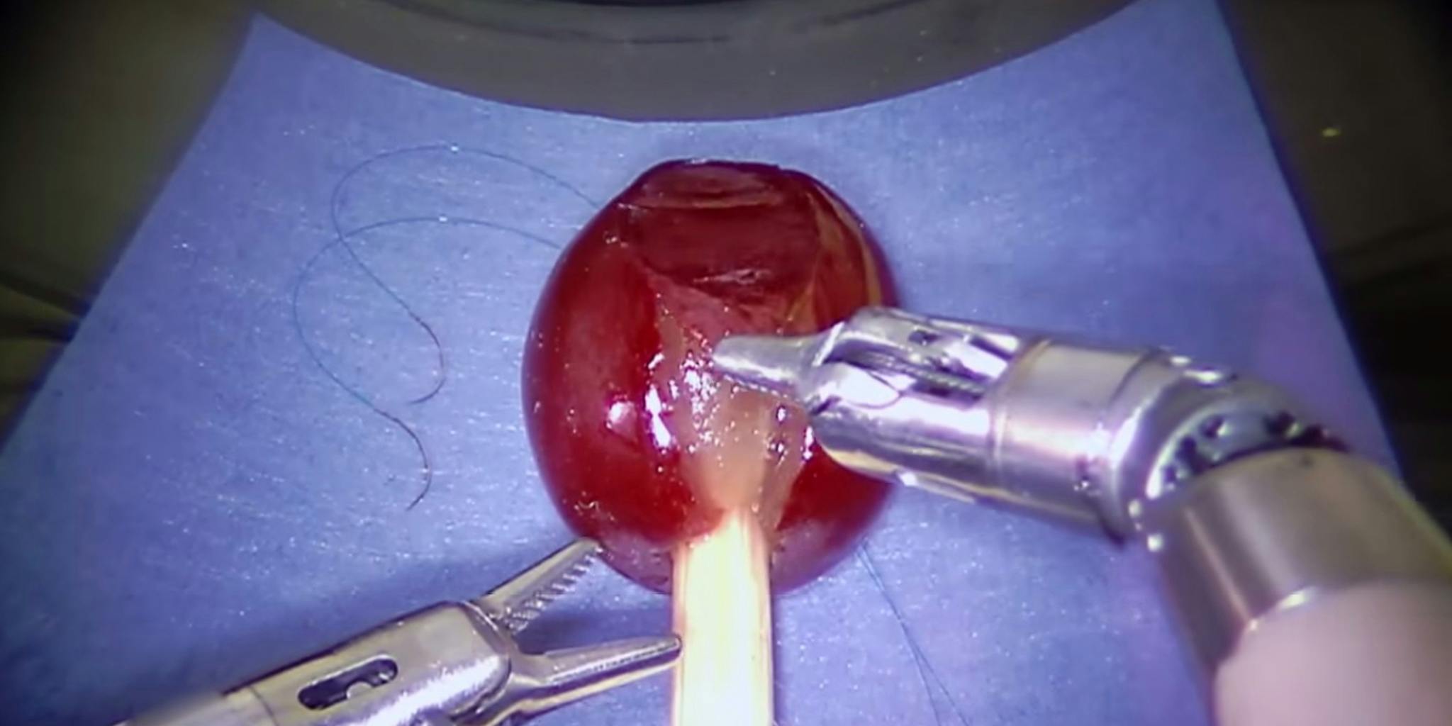 tankevækkende kaos kommando Tiny robot practices surgery on a wounded grape - The Daily Dot