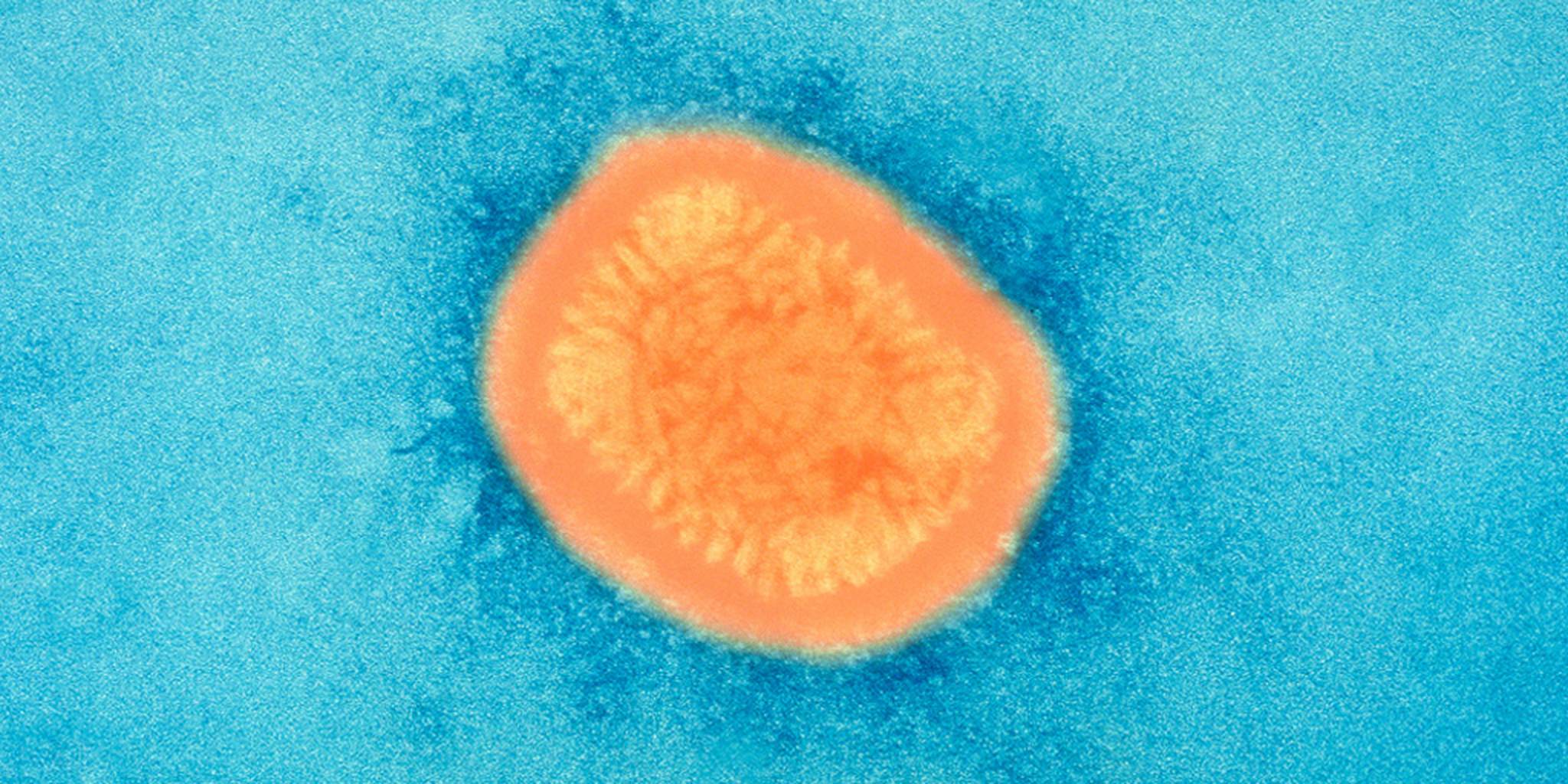 Homepage article image