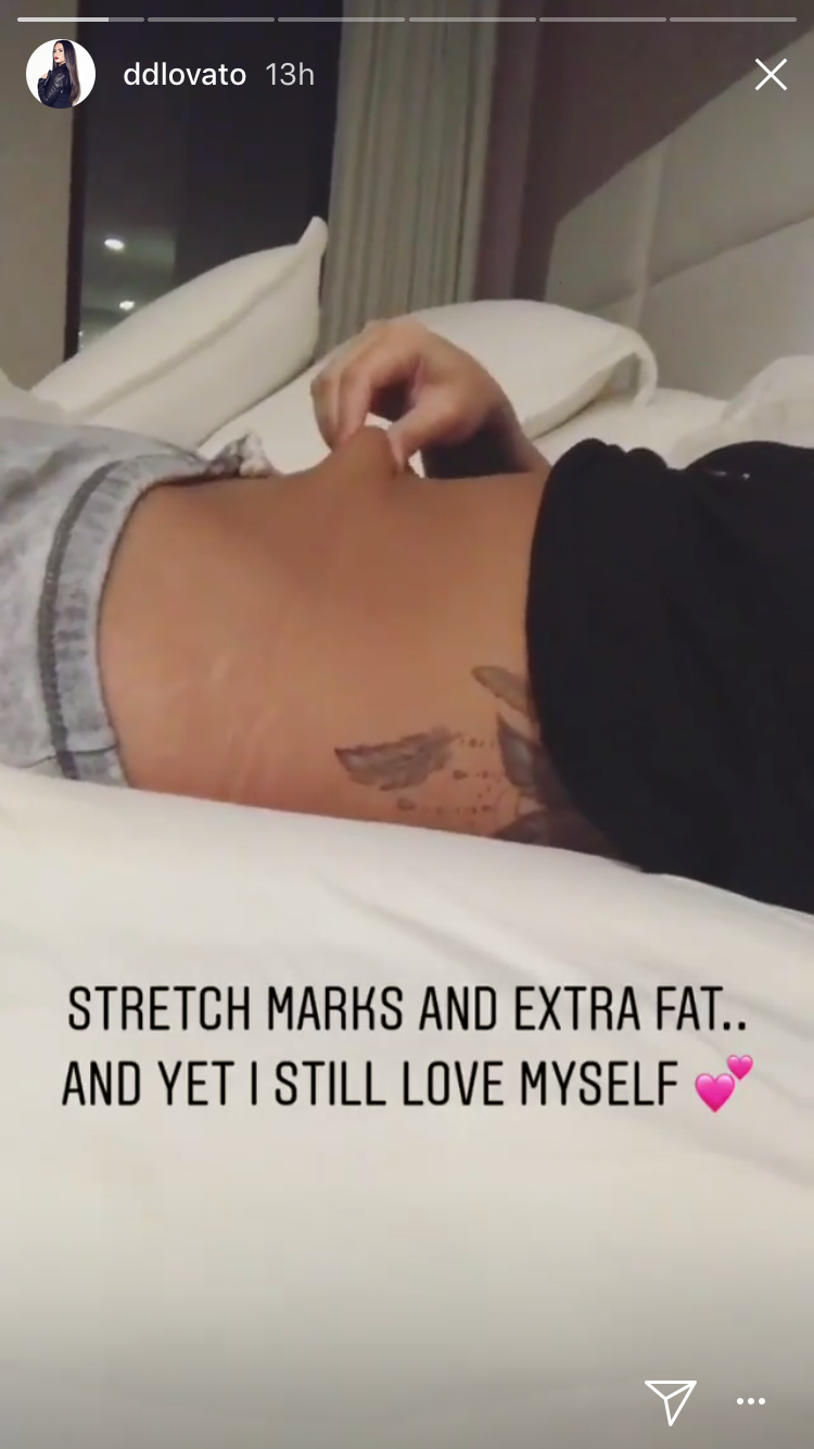 Demi Lovato shared photos of her stretch marks, cellulite, and no-gap thighs on Instagram.