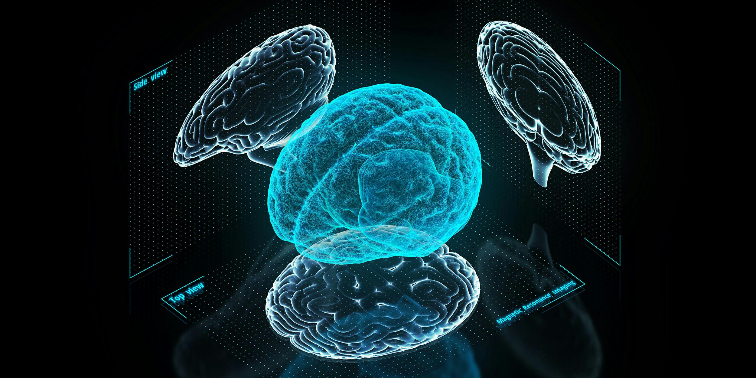 3D holographic brain