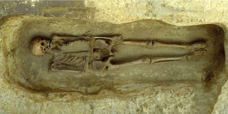 skeleton with knife arm prosthetic