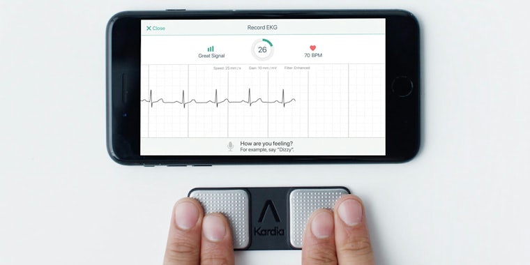 AliveCor heart attack app