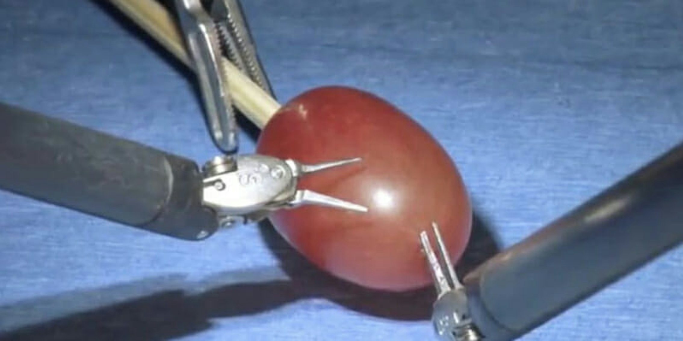 surgery on a grape