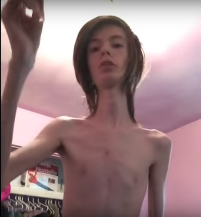 Wide Neck Guy Meets Daddy Long Neck