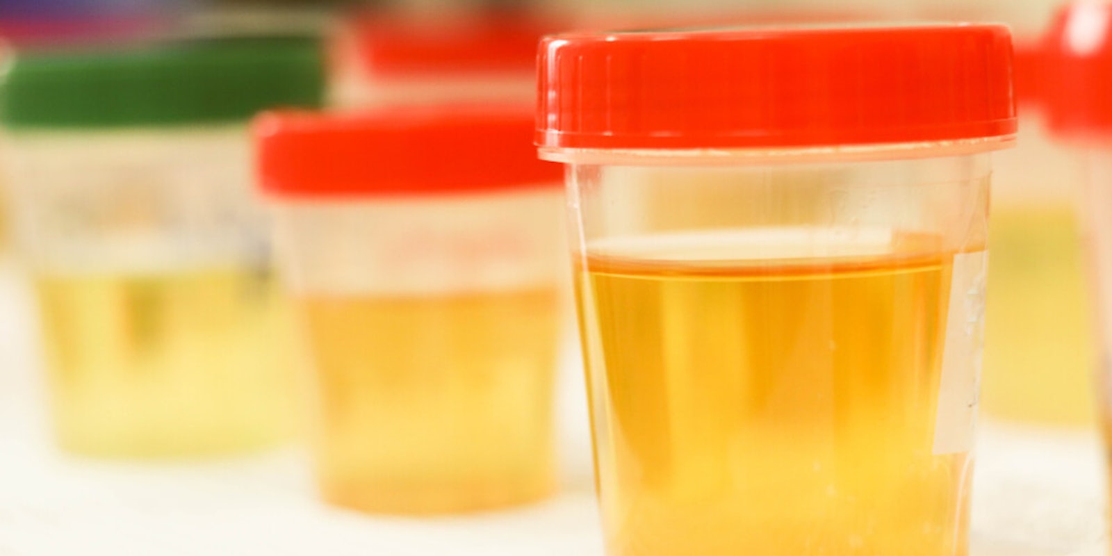 urine therapy