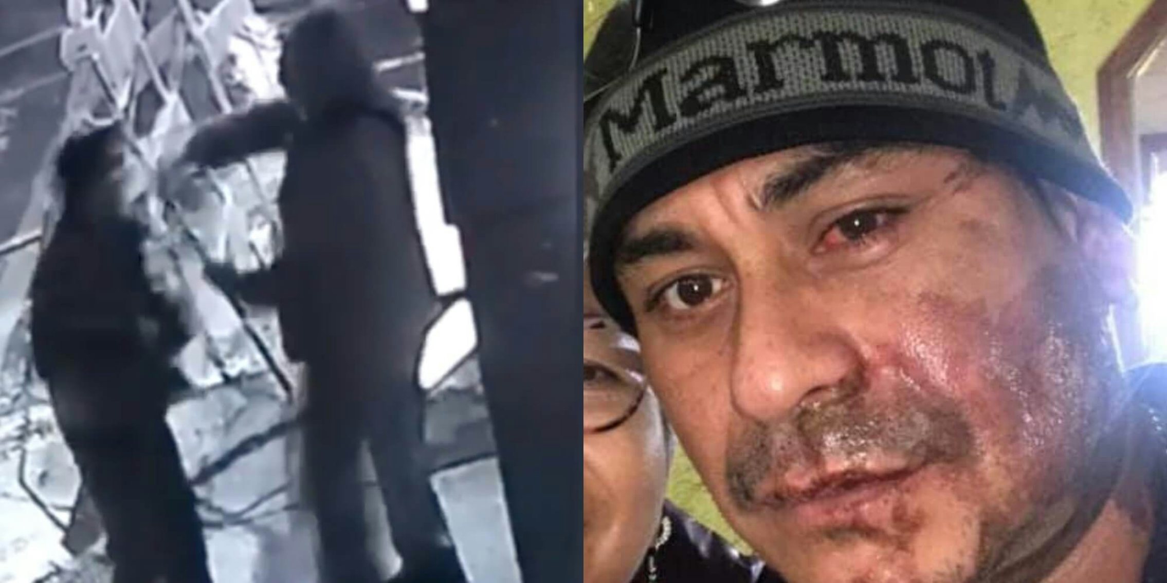 Left: white man seen throwing acid on the face of Mahud Villalaz, right: Mahud Villalaz with second degree burns on his face