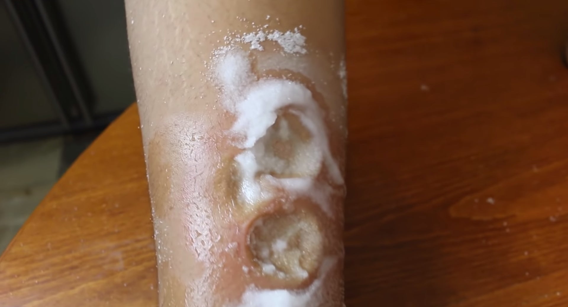 salt and ice challenge