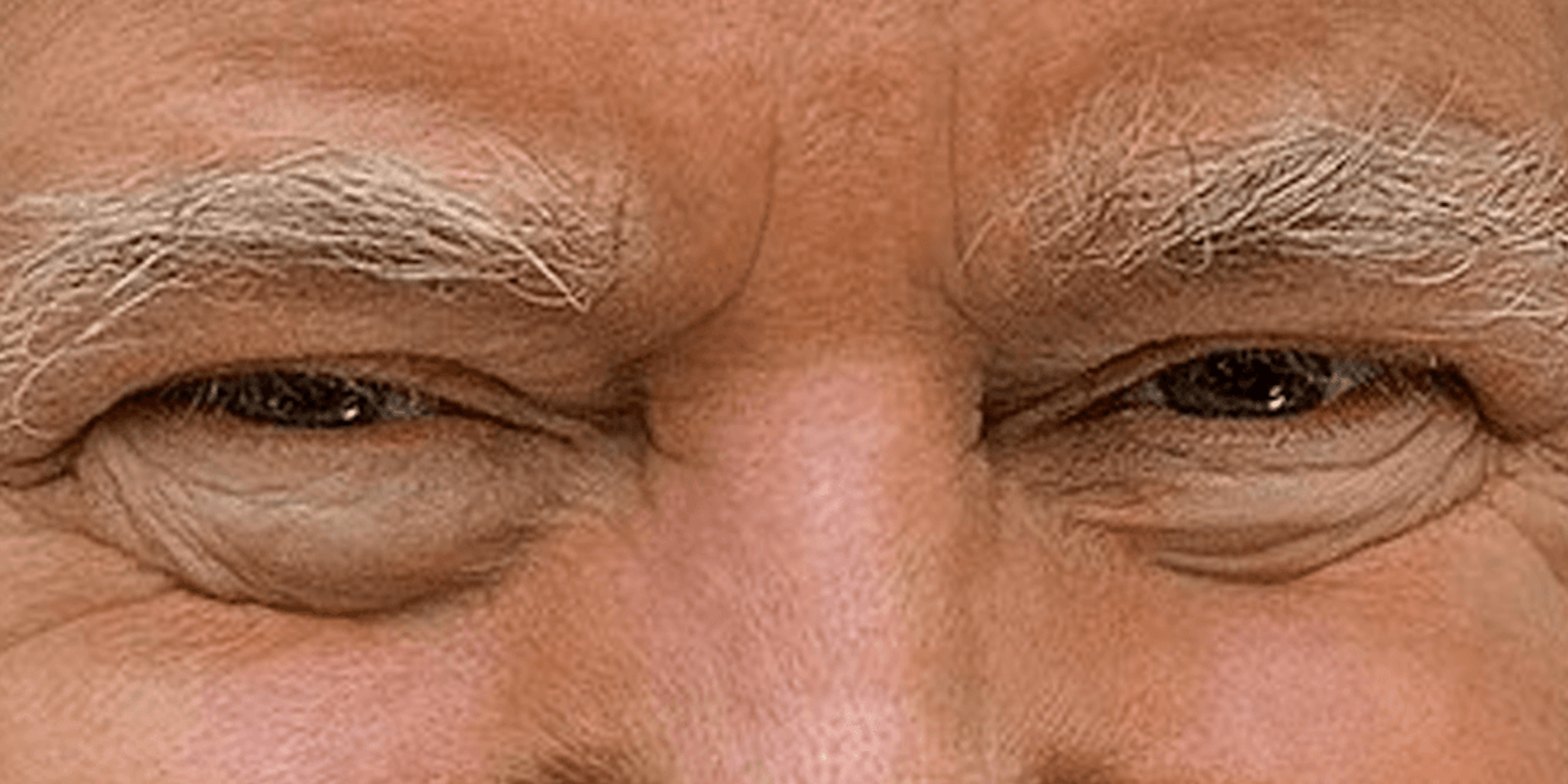 A closeup of President Donald Trump's face.