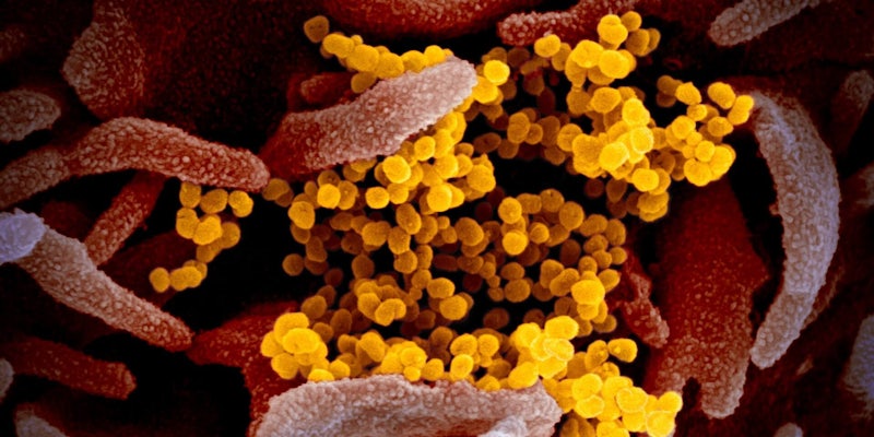 Microscopic image of Coronavirus-2019