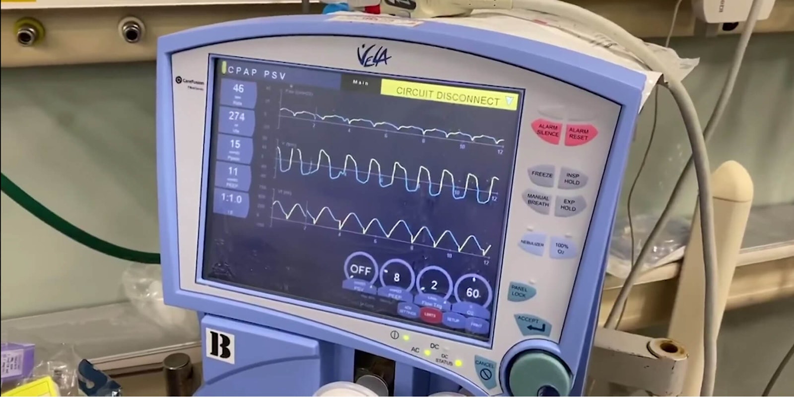 A CPAP machine in a hospital