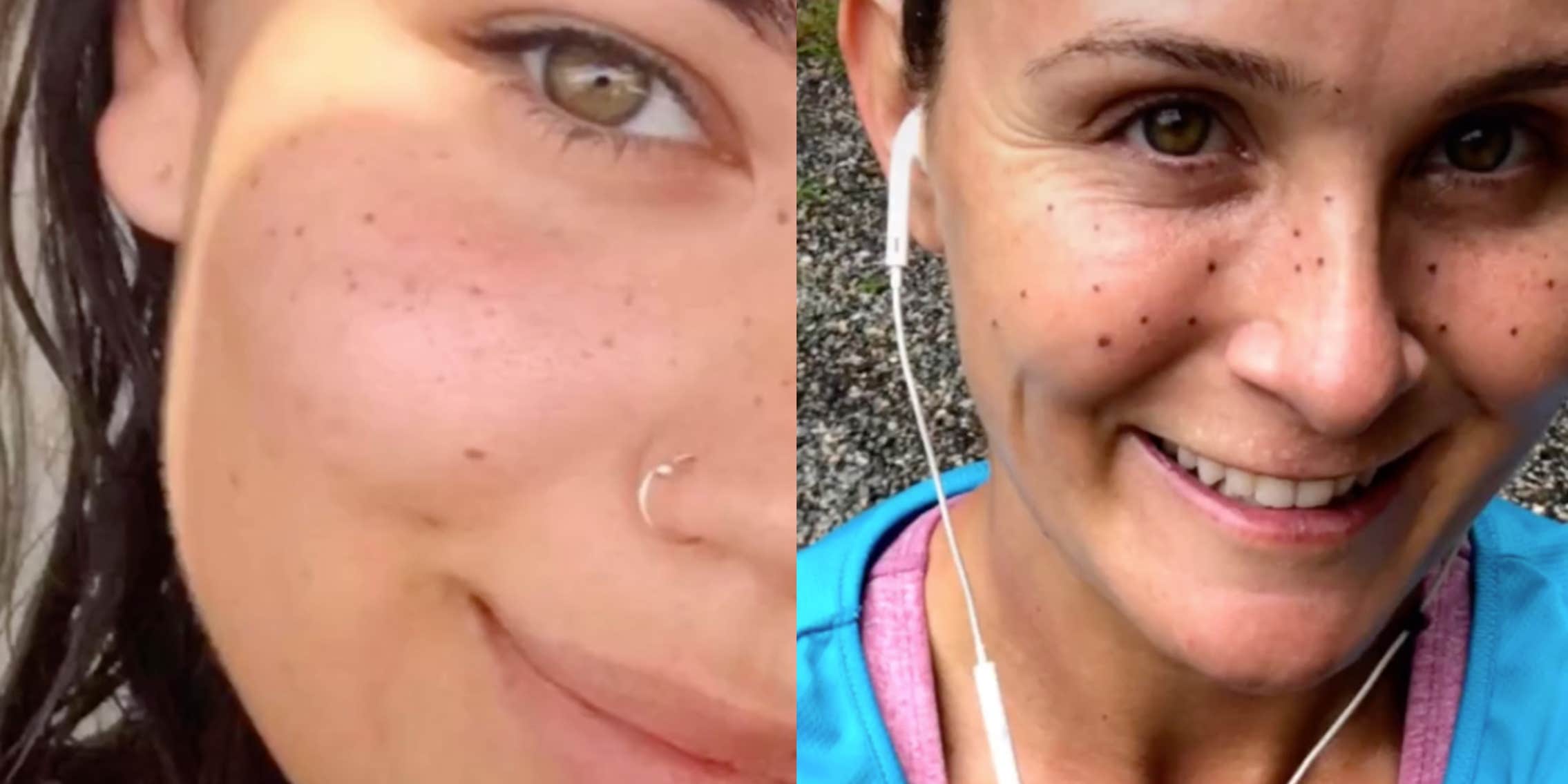 TikToker's Attempt At Freckle Tattoos Goes Horribly Wrong