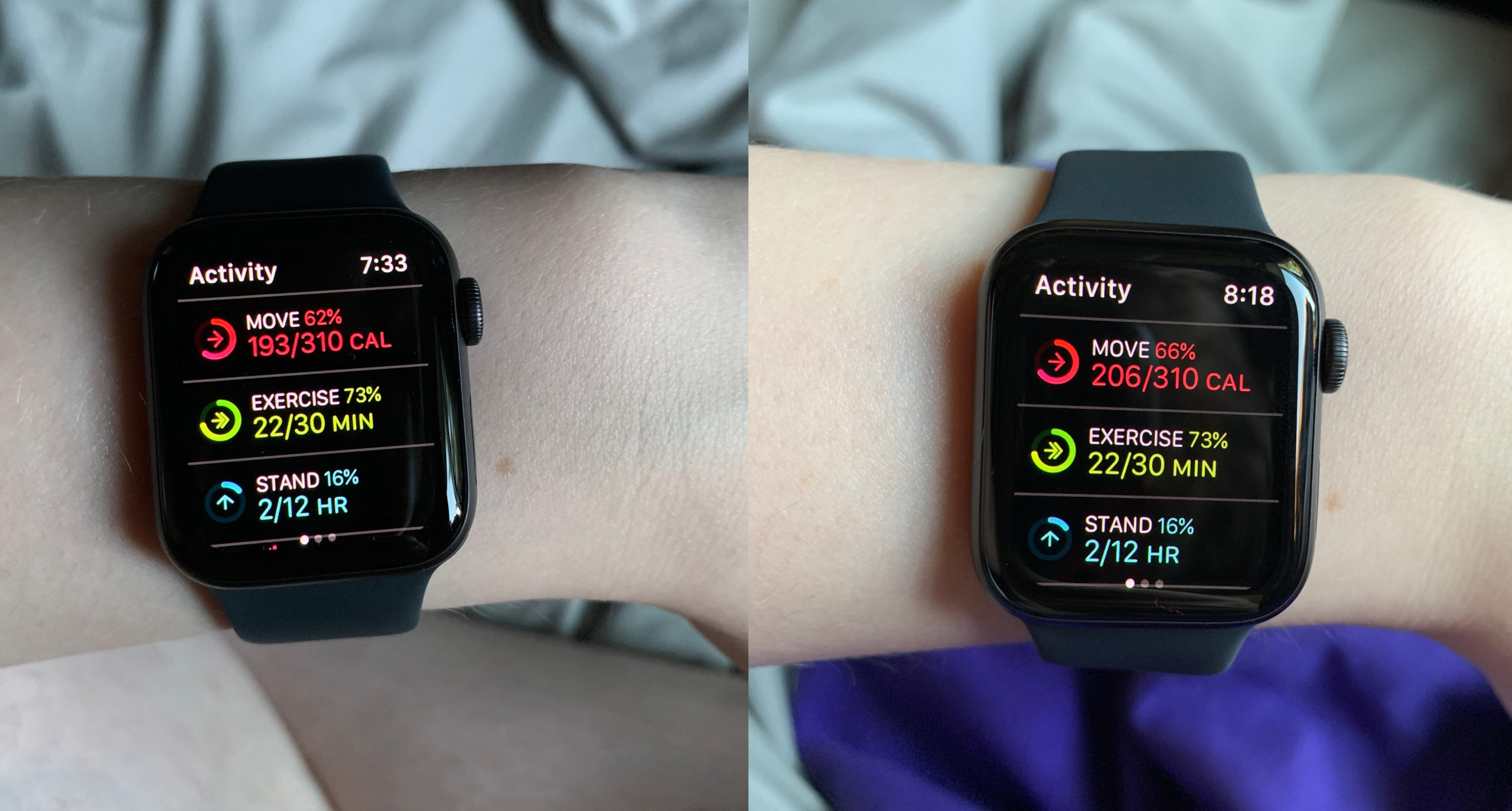 Privacy Rights Apple Watch Tracks Activity During image image