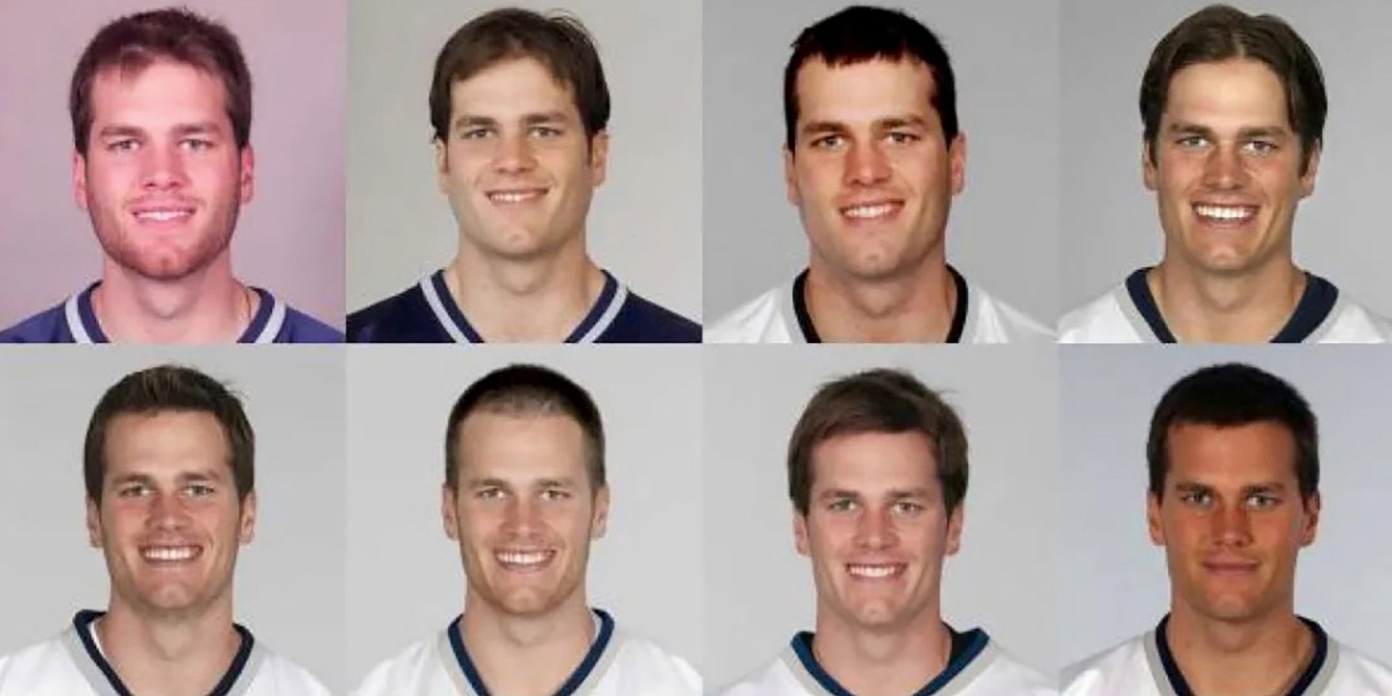 Has Tom Brady Had Work Done? Plastic Surgery Twitter Thinks So