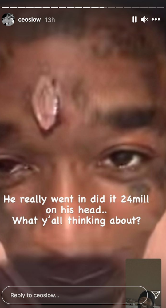 Tatuagens Lil Uzi Vert : People close to the situation are saying Young Thug has : The philly rapper showed off his latest tattoo inside his mouth.