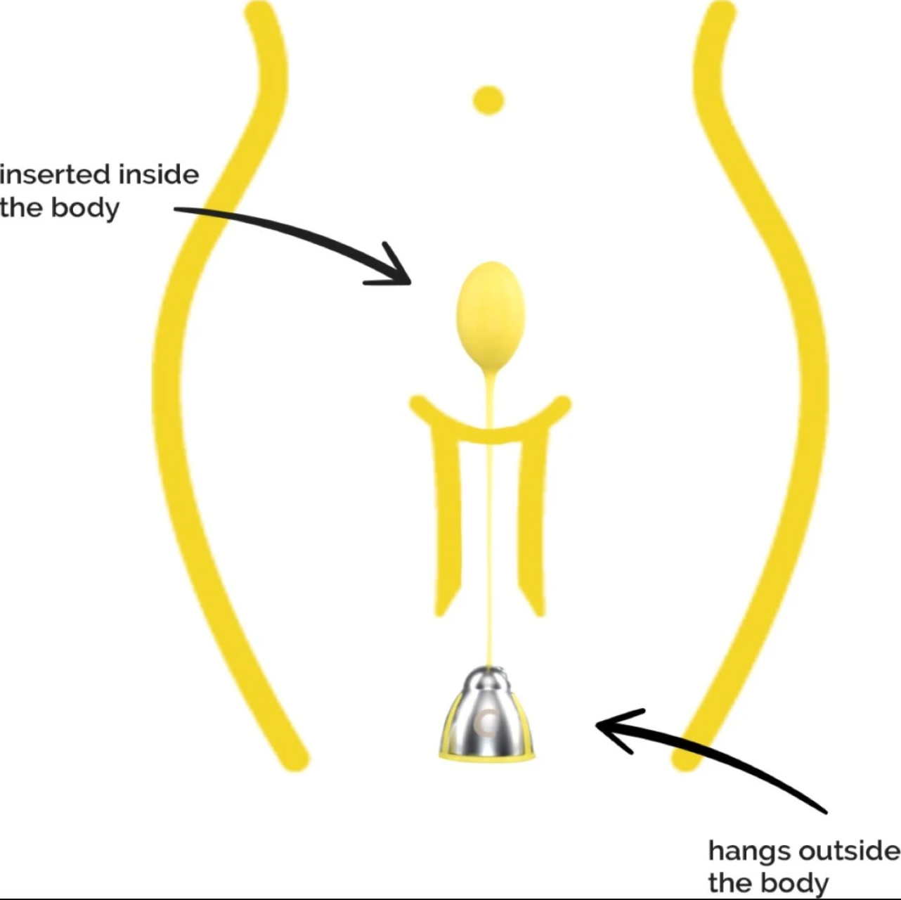 Diagram of the Kegelbell inserted