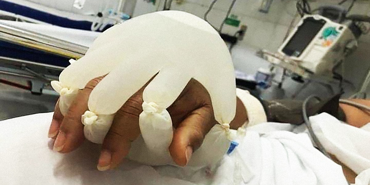 A fake plastic hand on a human hand.