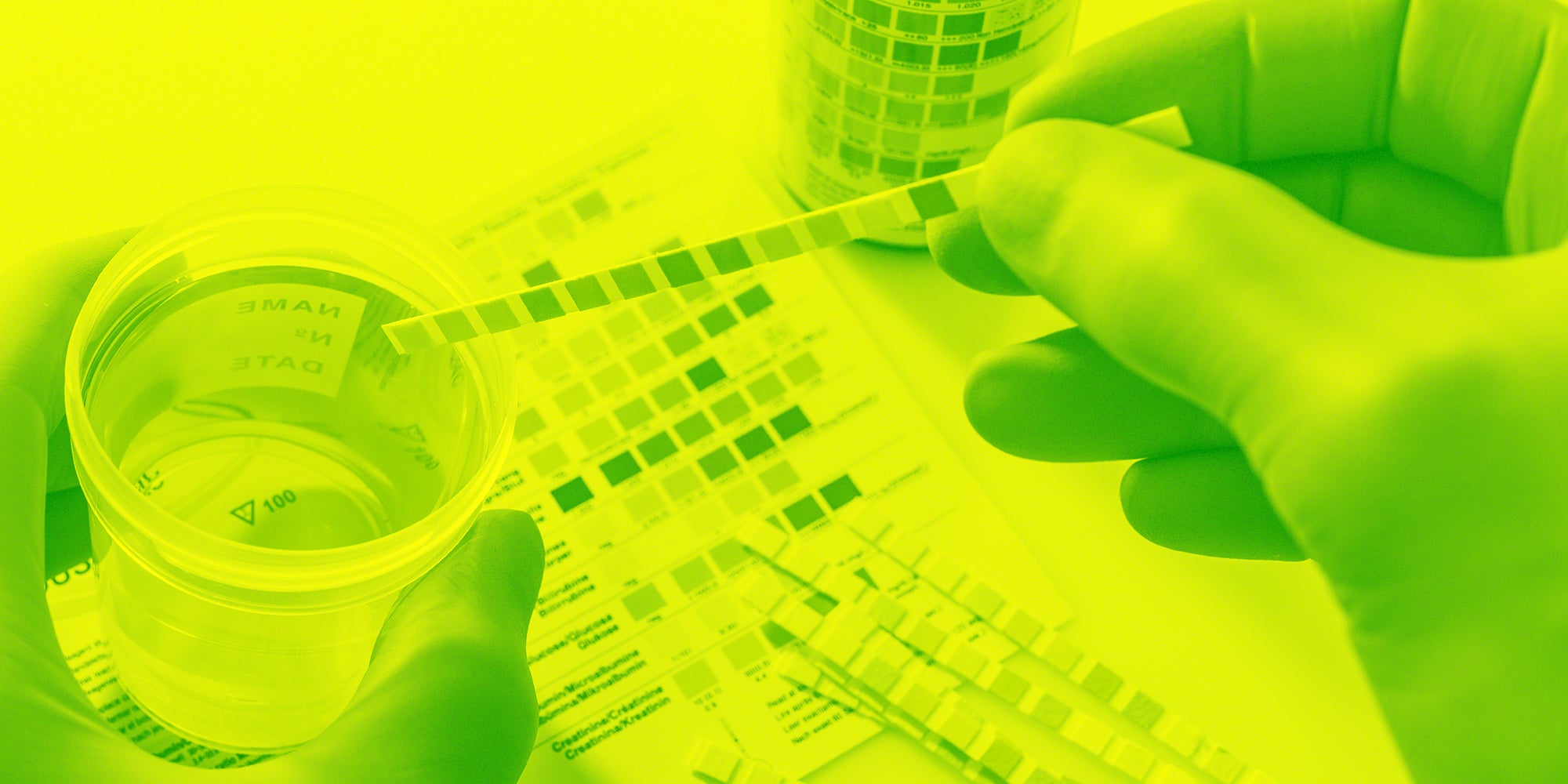 A drug test kit being used.