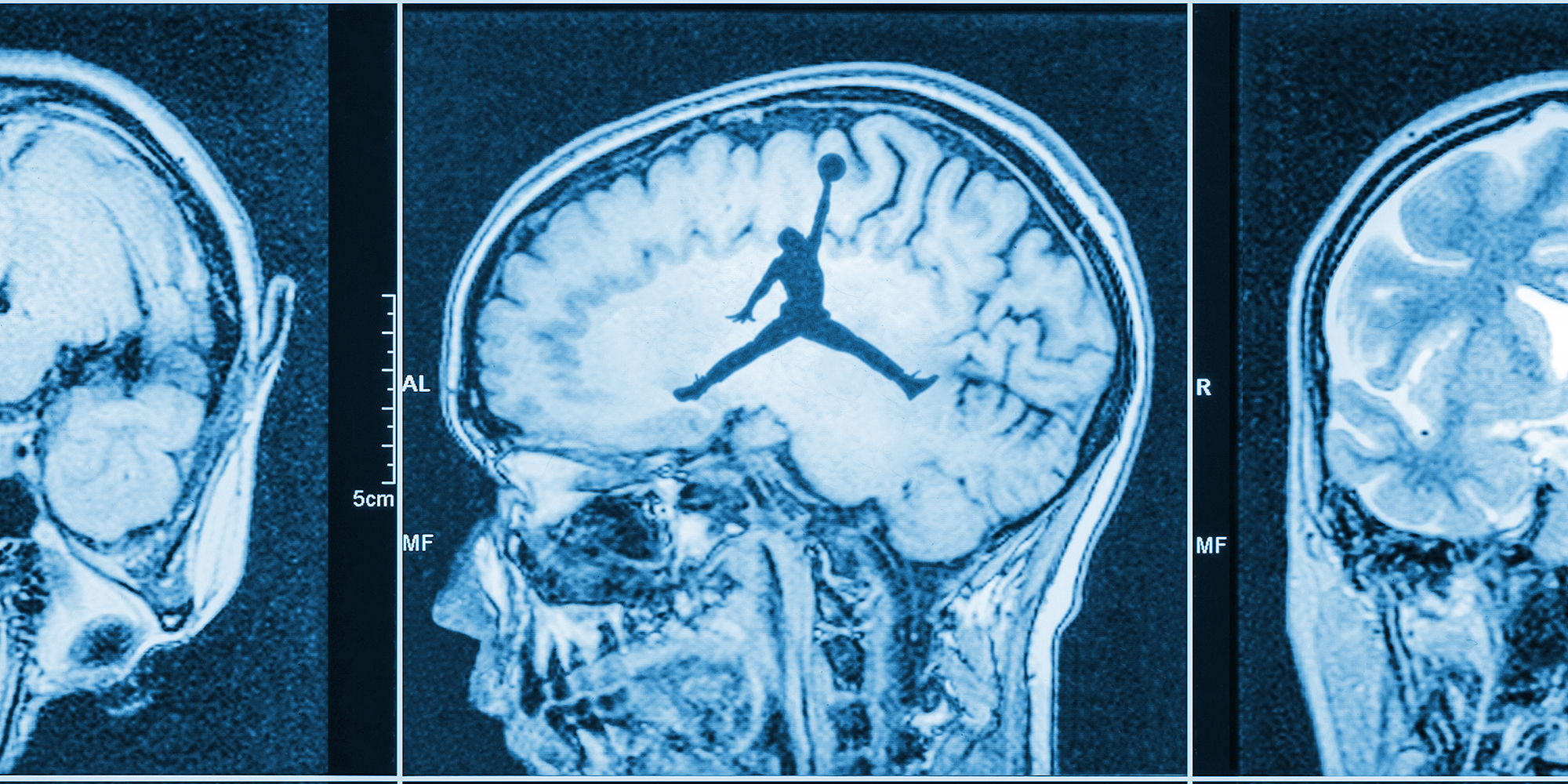 Brain scan with Jumpman logo in the center