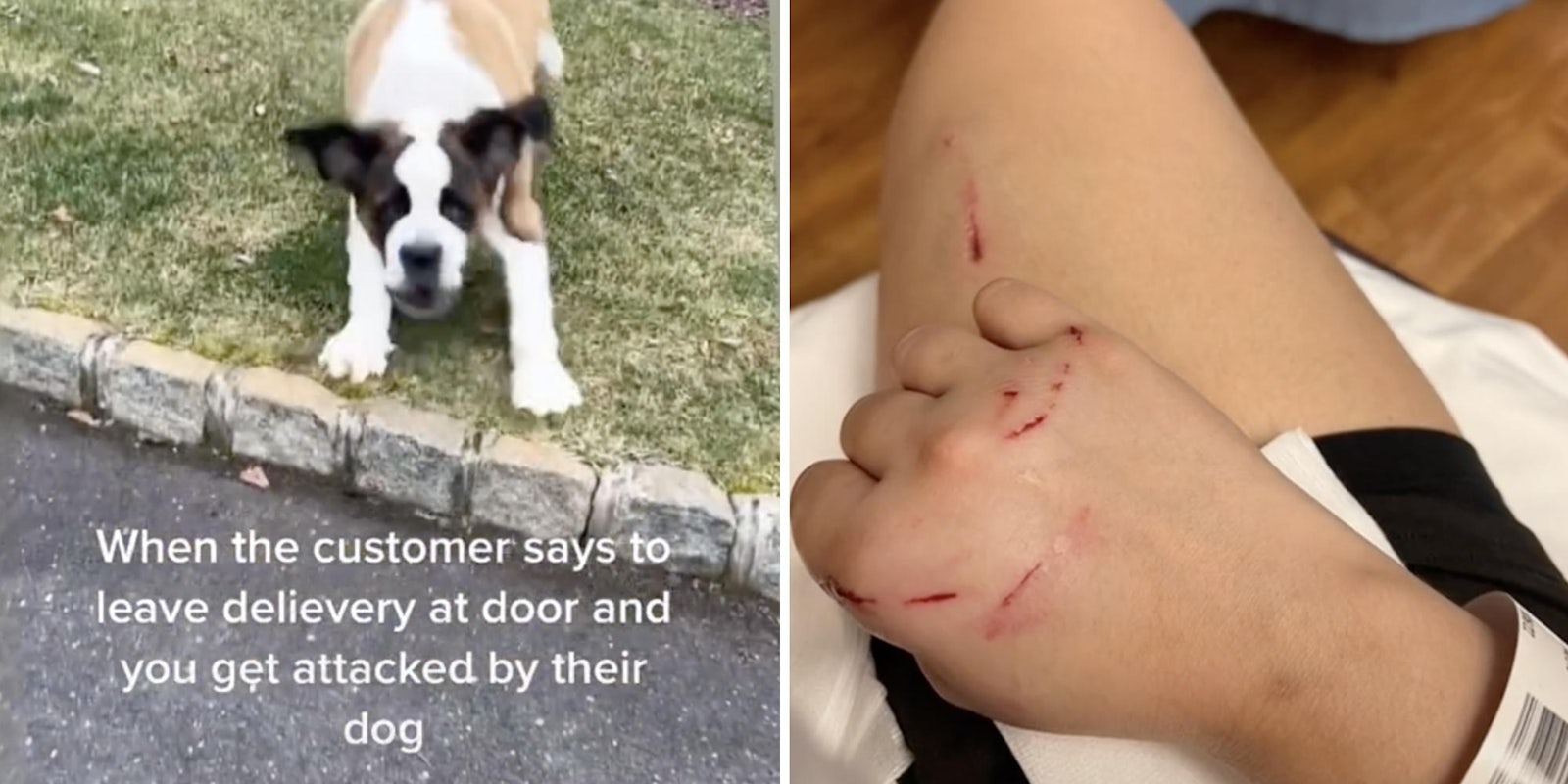 dog rushing at viewer (l) injured hand (r)