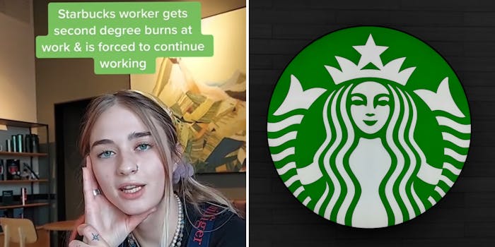 Woman hand on side of face caption "Starbucks worker gets second degree burns at work & is forced to continue working (l) starbucks circular logo over black wood background (r)