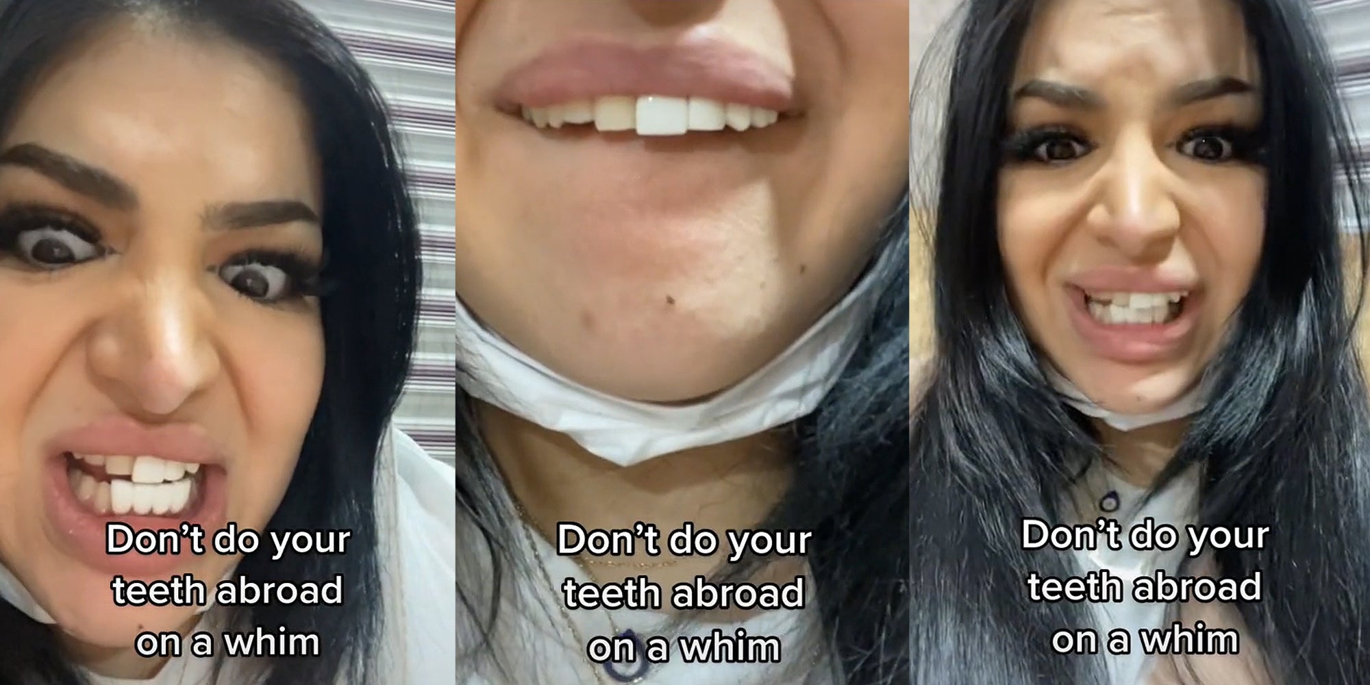 TikToker Gets Veneers, Urges Viewers Not To Do ‘Teeth Abroad’