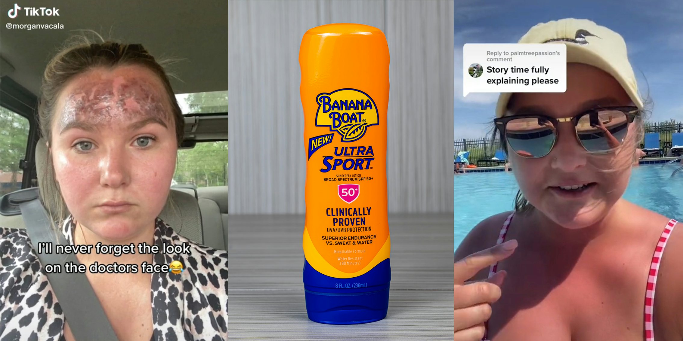 young woman with severe sunburn on forehead in car with caption 'i'll never forget the look on the doctors face' (l) banana boat sunscreen (c) young woman in pool with hat and glasses with caption 'story time fully explaining please'