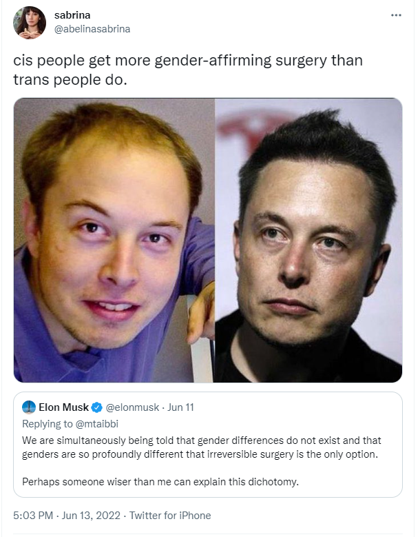 elon musk hair plugs