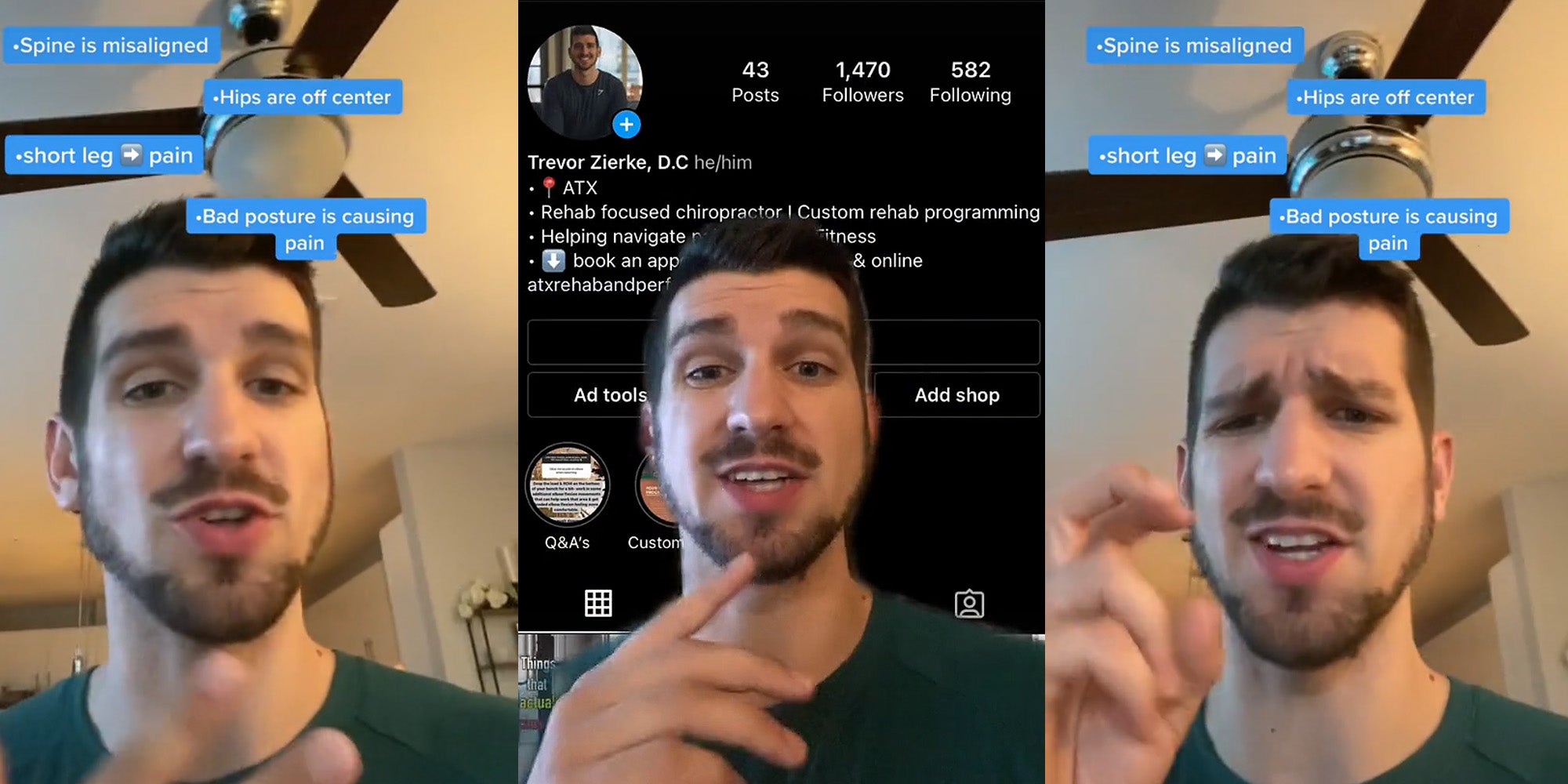 chiropractor speaking hand up caption '*Spine is misaligned *Hips are off center *short leg pain *Bad posture is causing pain' (l) Chiropractor greenscreen TikTok over his Instagram page (c) chiropractor speaking with air quotes finger sign caption '*Spine is misaligned *Hips are off center *short leg pain *Bad posture is causing pain' (r)