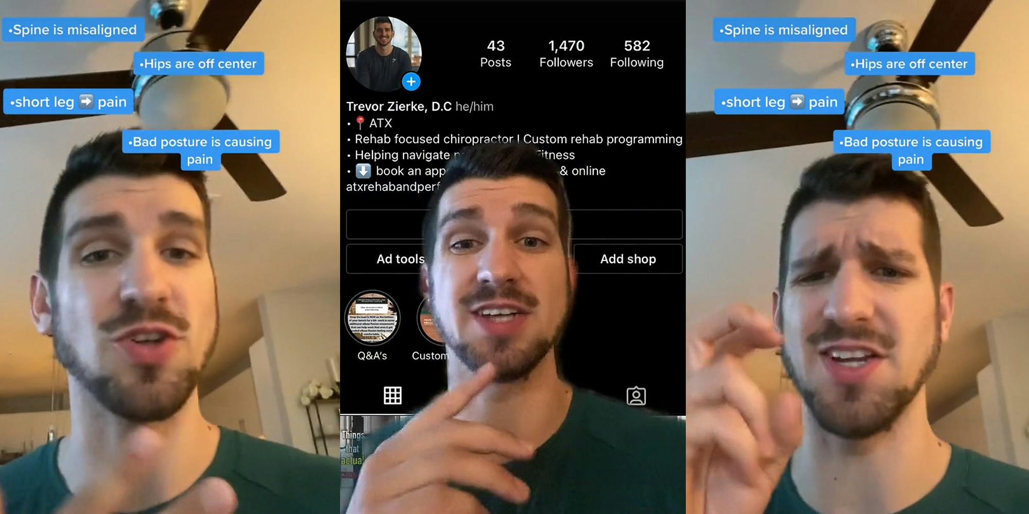 chiropractor speaking hand up caption "*Spine is misaligned *Hips are off center *short leg pain *Bad posture is causing pain" (l) Chiropractor greenscreen TikTok over his Instagram page (c) chiropractor speaking with air quotes finger sign caption "*Spine is misaligned *Hips are off center *short leg pain *Bad posture is causing pain" (r)