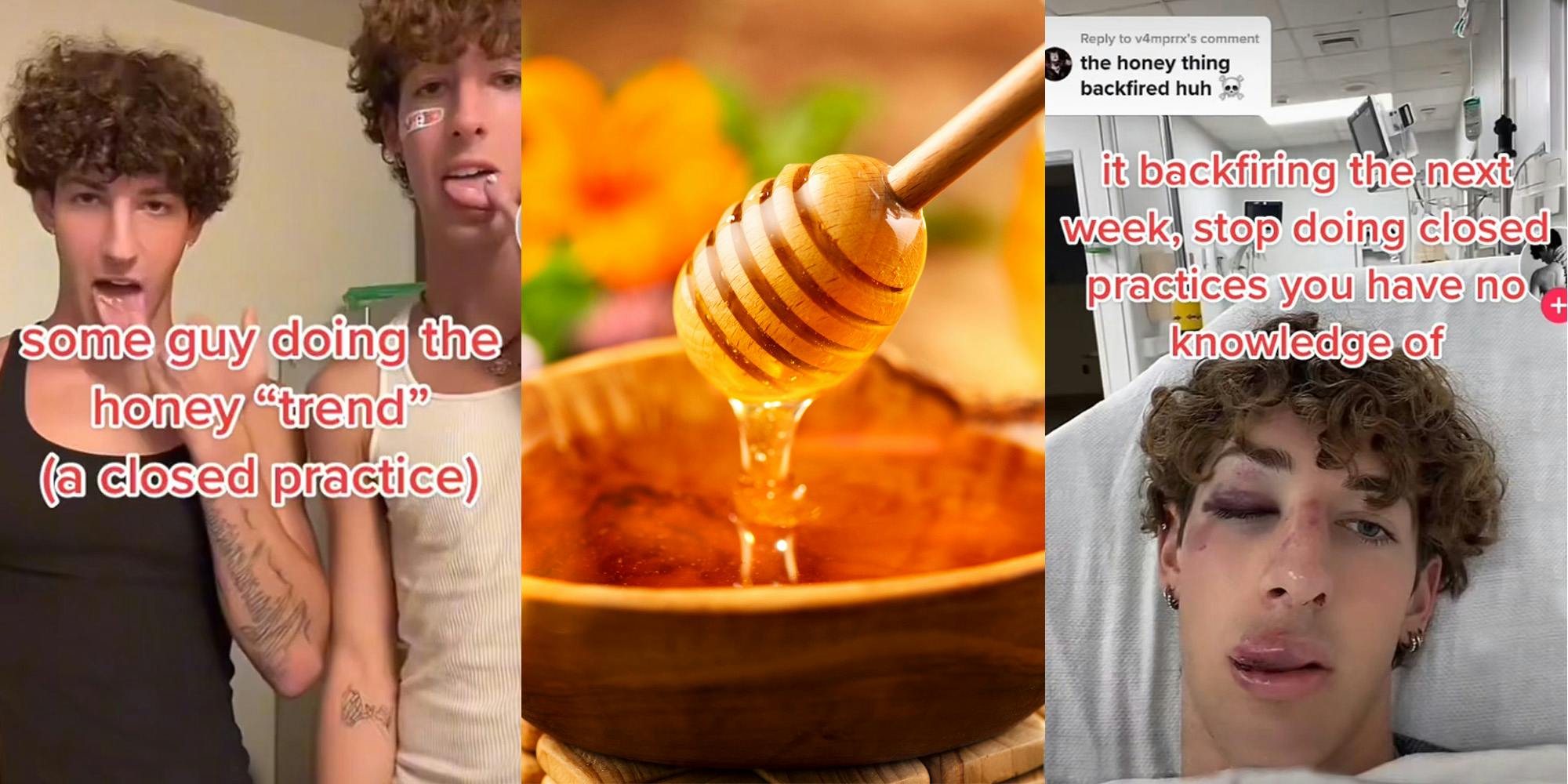 men sticking tongues out putting honey caption "some guy doing the honey "trend" (a closed practice) (l) honey dripping off of honey dipper (c) man in hospital caption "the honey thing backfired huh" "it backfired the next week, stop doing closed practices you have no knowledge of" (r)