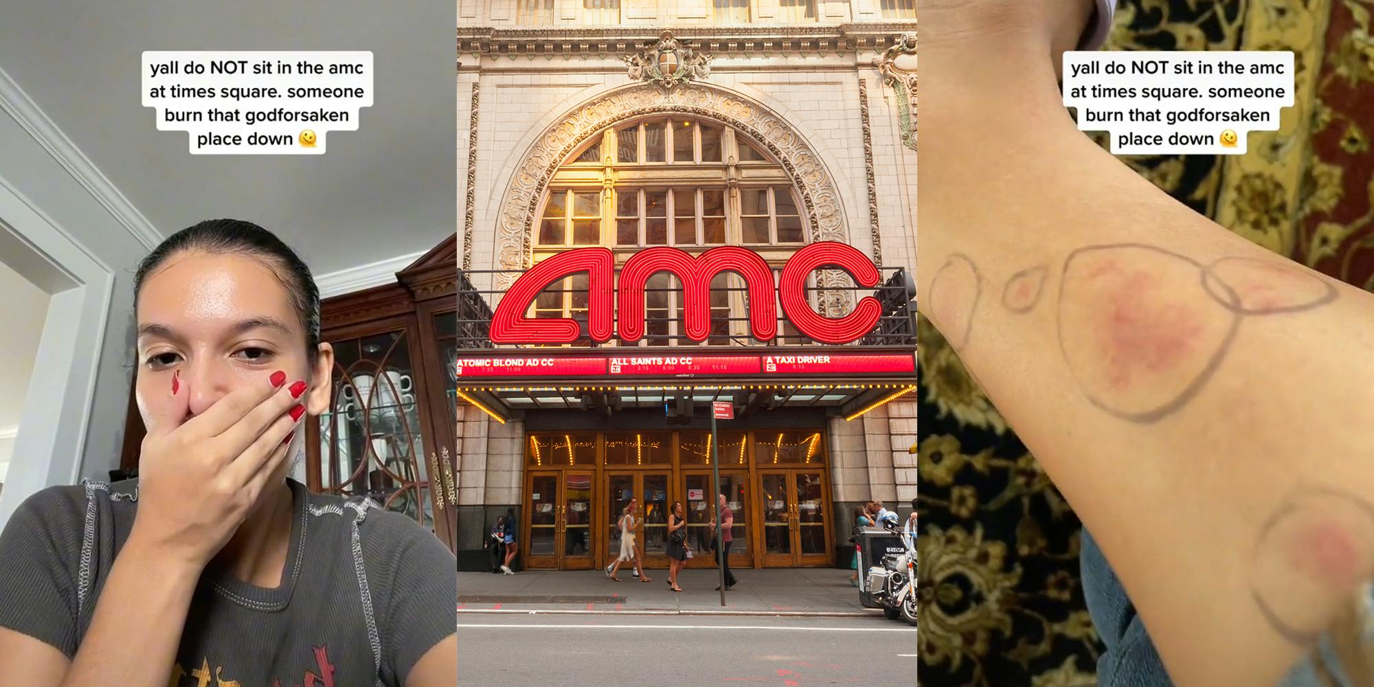 woman with mouth covered and caption "yall do NOT sit in the amc at times square, someone burn that godforsaken place down" (l) AMC theater in Times Square (c) leg with bites circled (r)