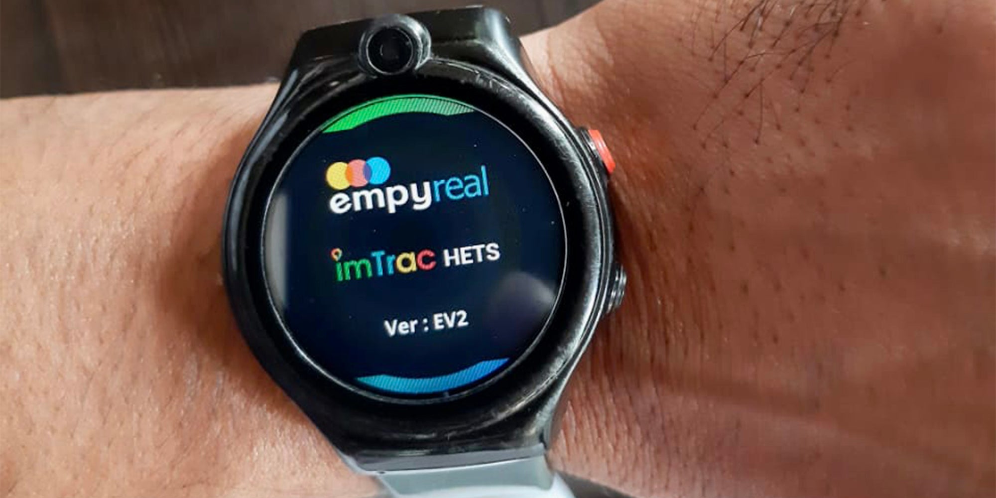 Homepage article image