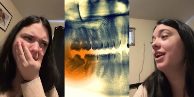 woman with hand on mouth speaking (l) X-Ray of wisdom tooth (c) woman speaking (r)
