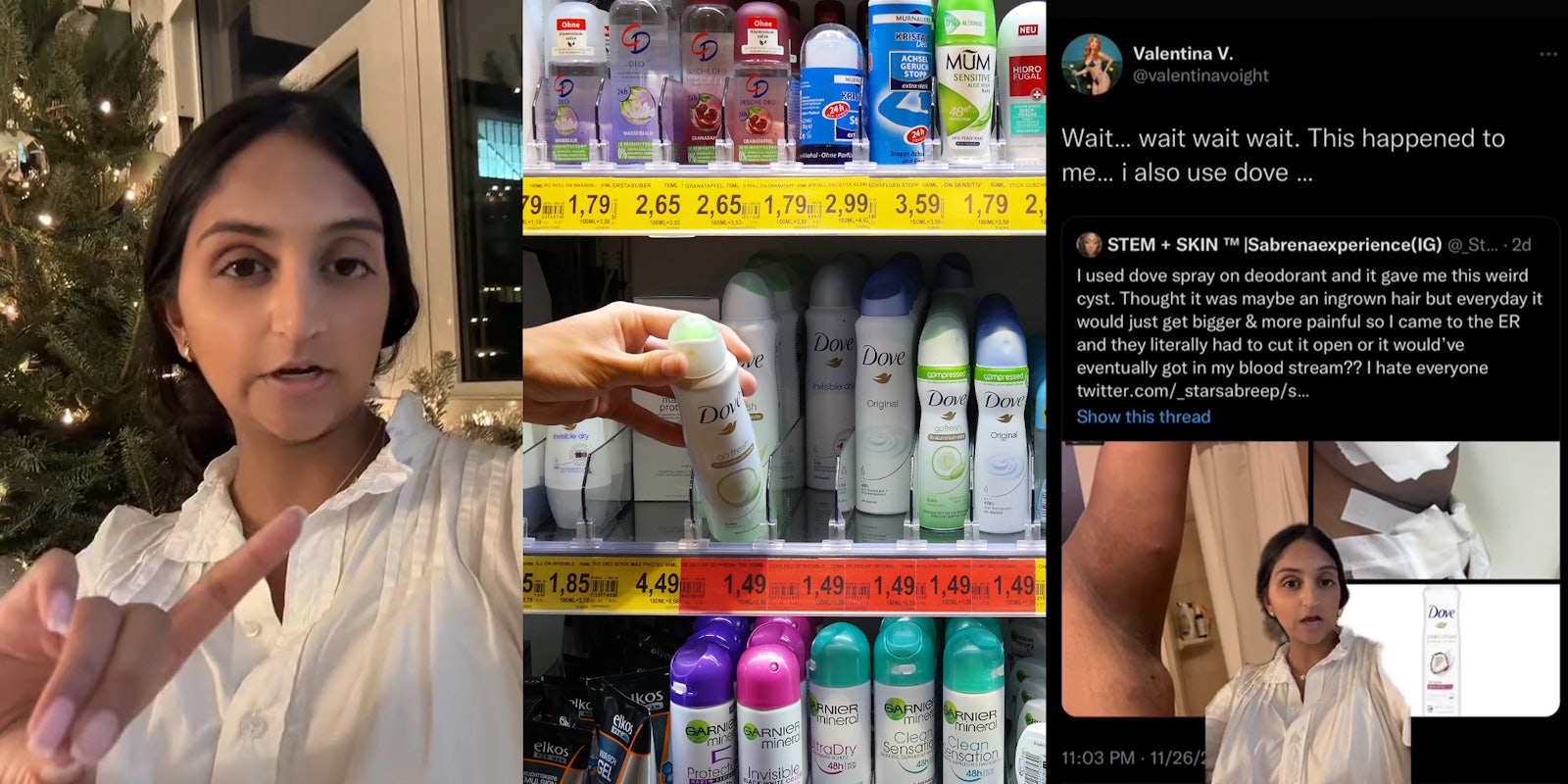 woman speaking with finger pointing (l) person grabbing Dove spray deodorant from store shelf (c) woman greenscreen TikTok over Tweet by Valentina V. 'wait... wait wait wait. This happened to me... i also use dove...' with Tweet by Sabrenaexperience 'I used dove spray deodorant and it gave me this weird cyst. Thought it was maybe an ingrown hair but everyday it would just get bigger & more painful so I came to the ER and they literally had to cut it open or it would've eventually got in my blood stream?? I hate everyone' with images of arm with cyst and Dove deodorant (r)