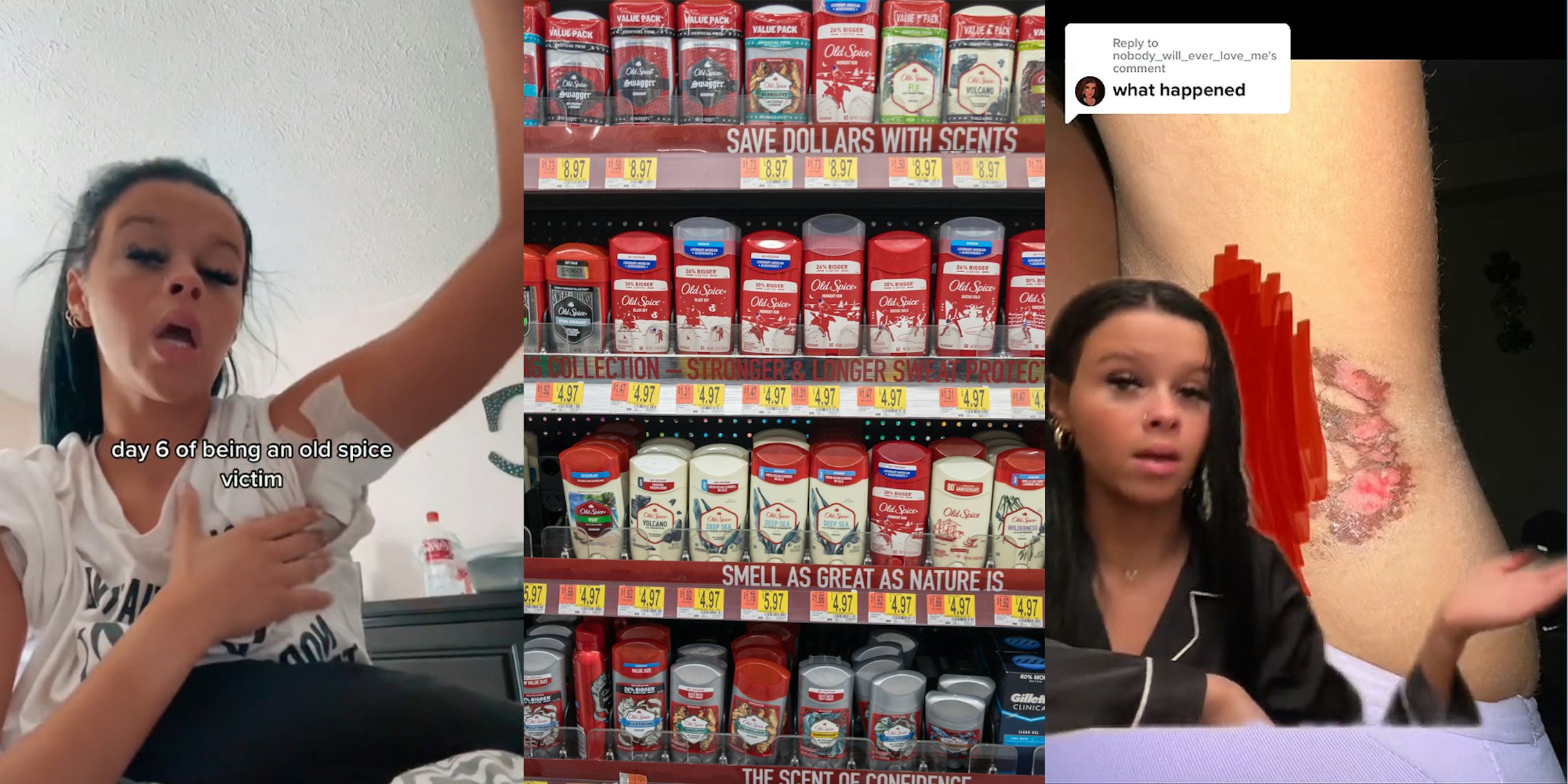 person holding up arm revealing bandage in armpit with caption 'day 6 of being an old spice victim' (l) Old Spice deodorants on shelf at store (c) person greenscreen TikTok over image of chemical burn in armpit with caption 'what happened' (r)