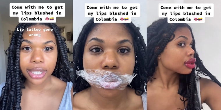 woman goes to Colombia to get her lips tattooed and it goes wrong