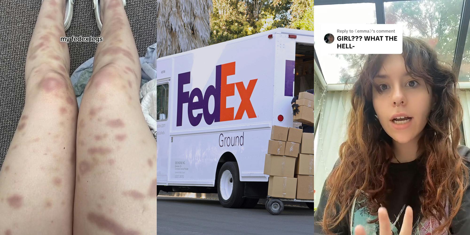 FedEx driver's legs covered in bruises with caption "my fedex legs" (l) FedEx worker onloading boxes from FedEx truck (c) FedEx driver speaking with caption "GIRL??? WHAT THE HELL-" (r)