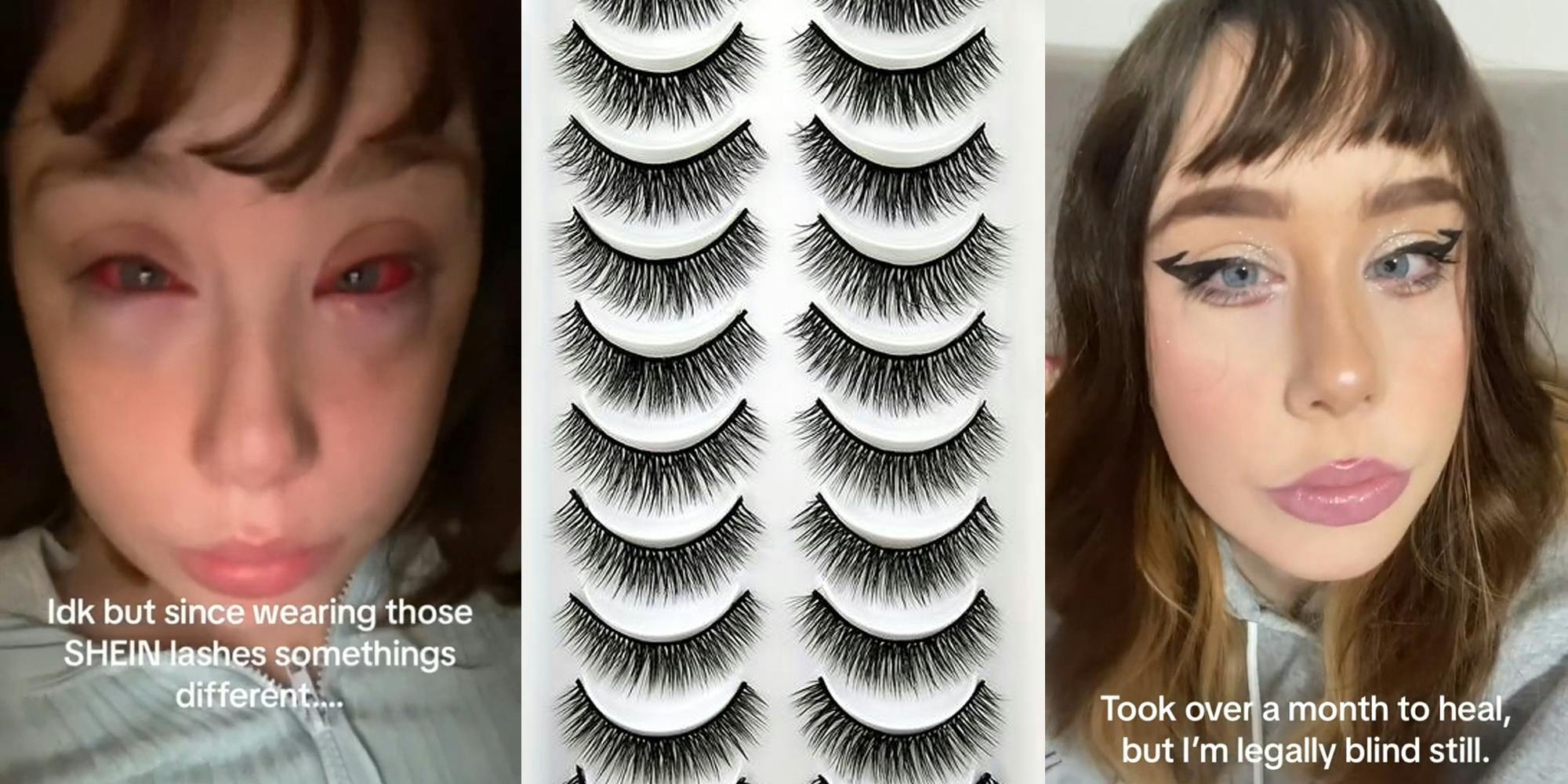 young woman with red eyes and caption "idk but since wearing those SHEIN lashes somethings different..." (l) fake lashes (c) young woman with caption "Took over a month to heal, but I'm legally blind still." (r)