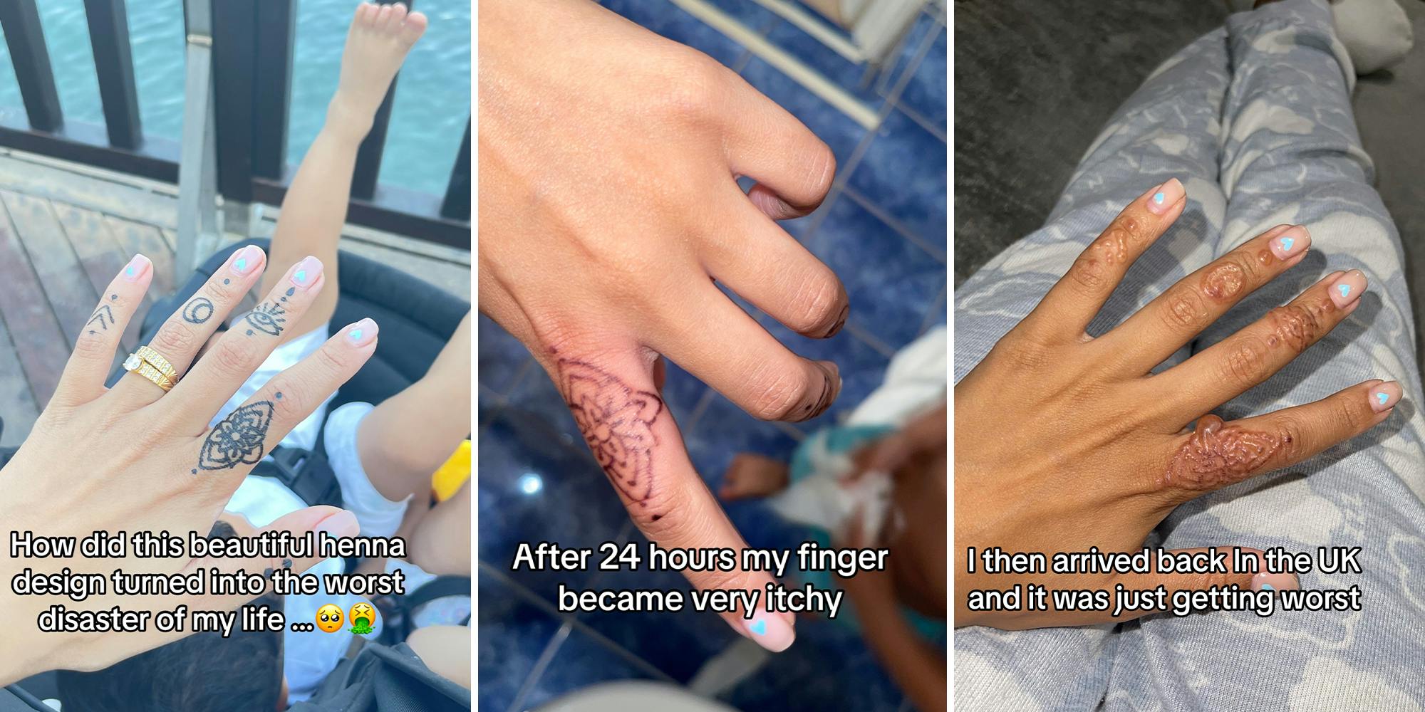 Woman gets henna tattoo on her hands. It becomes the 'worst disaster' of her life