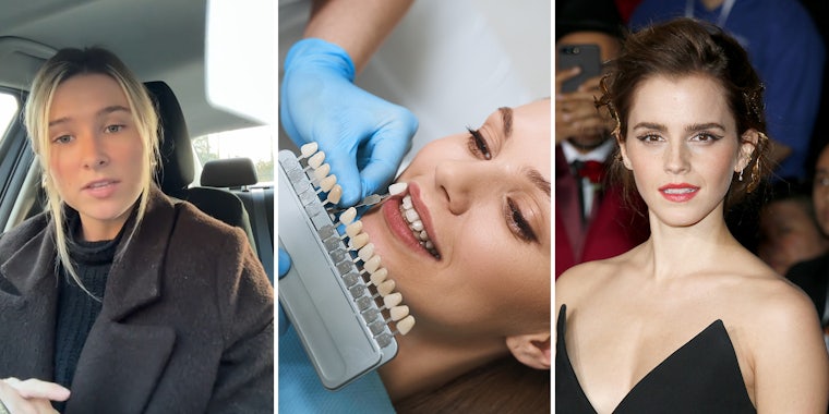 blonde woman wearing a coat; dentist aligning teeth; Emma Watson