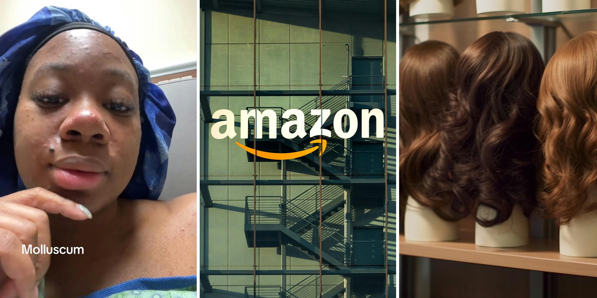Woman says Amazon wig sent her to the hospital