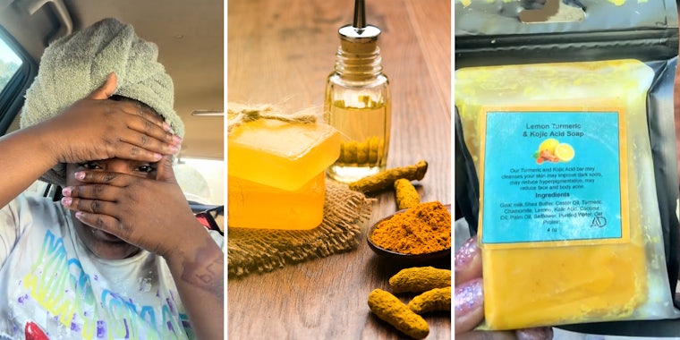 Woman shares warning on viral turmeric soap after it ‘burned’ her face