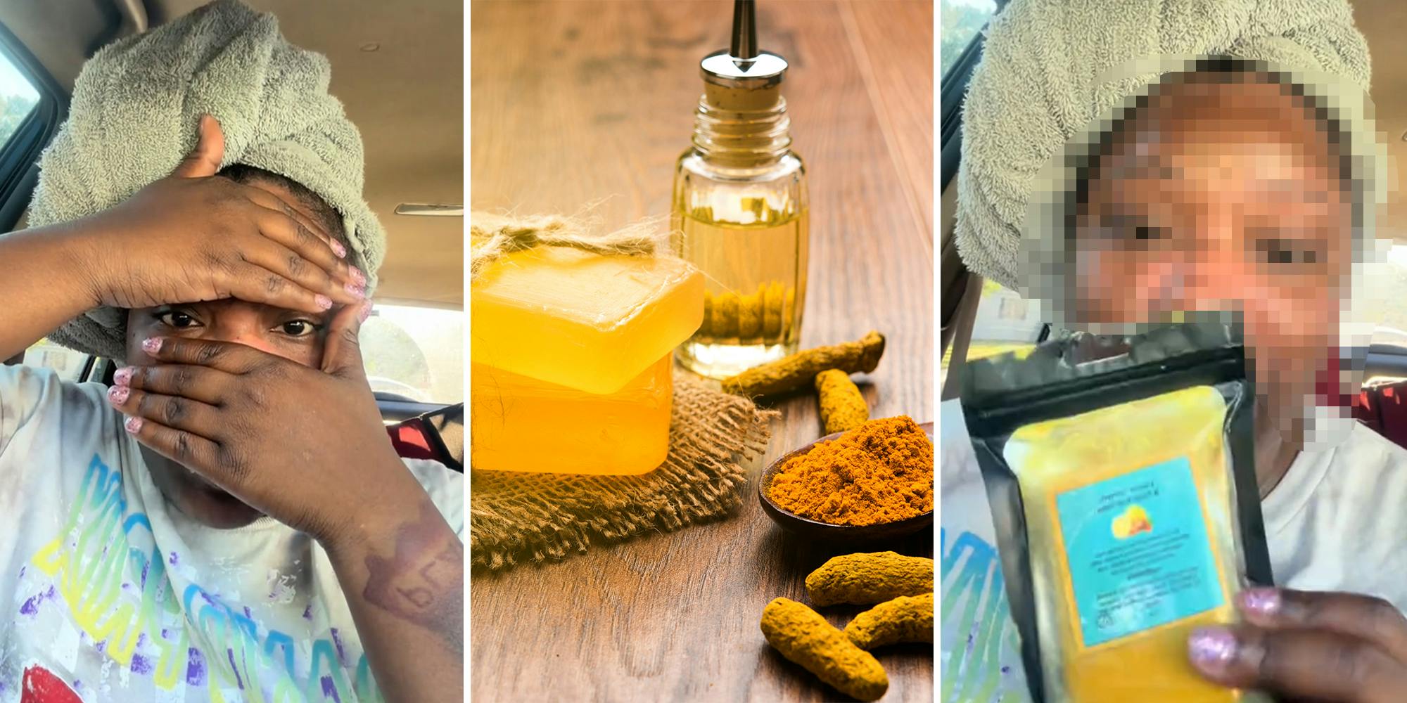 ‘My heart dropped’: Woman shares warning on viral turmeric soap after it ‘burned’ her face