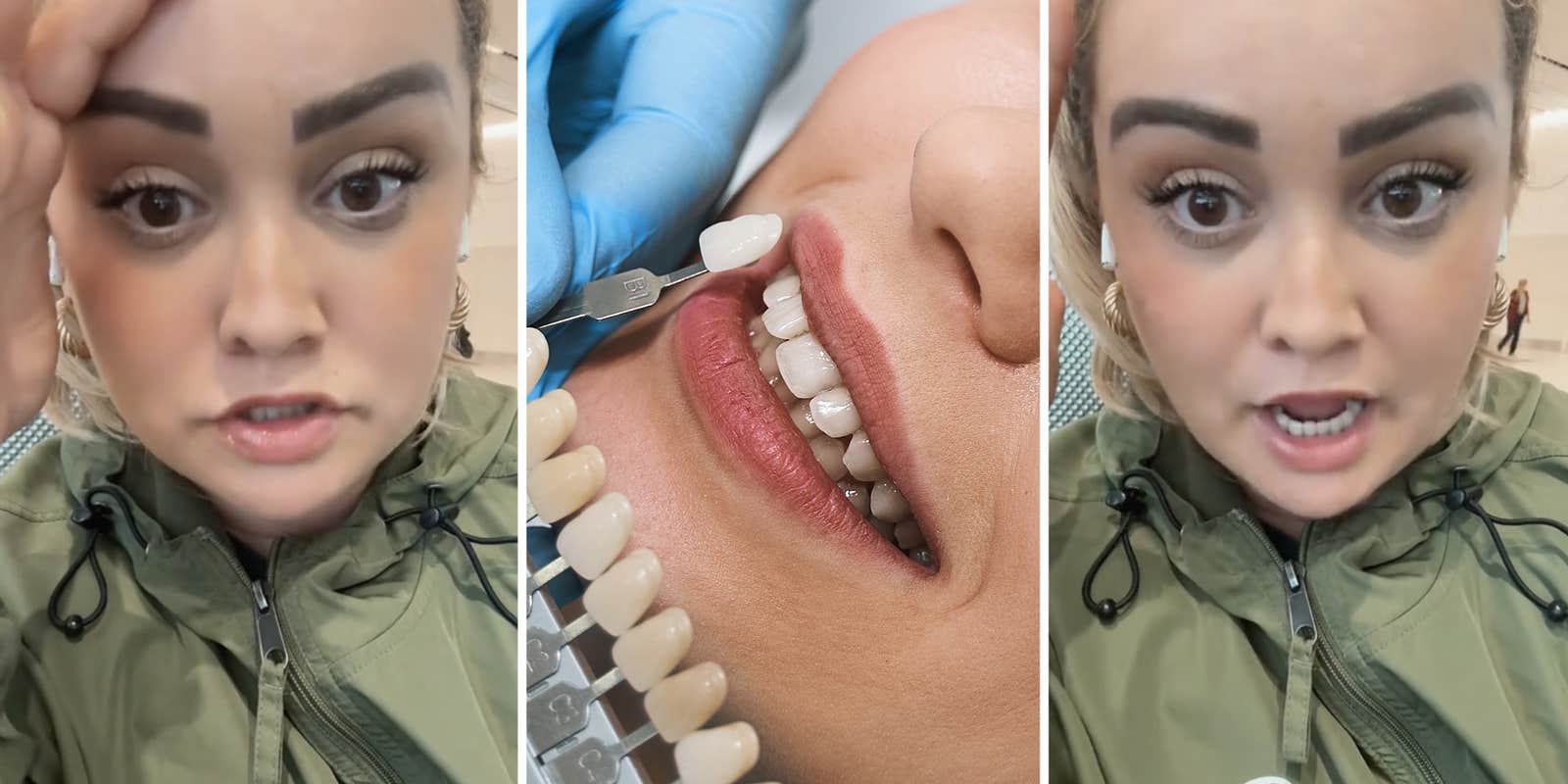 The Dangers of Veneer Techs: What Dentists Want You to Know
