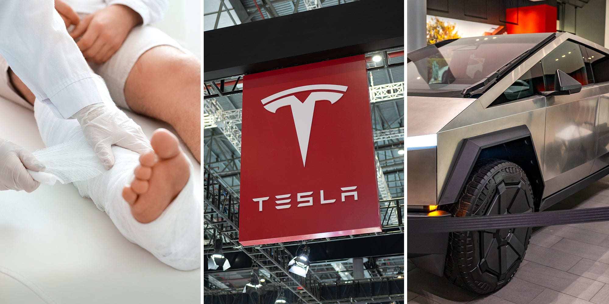 Cybertruck leg injury