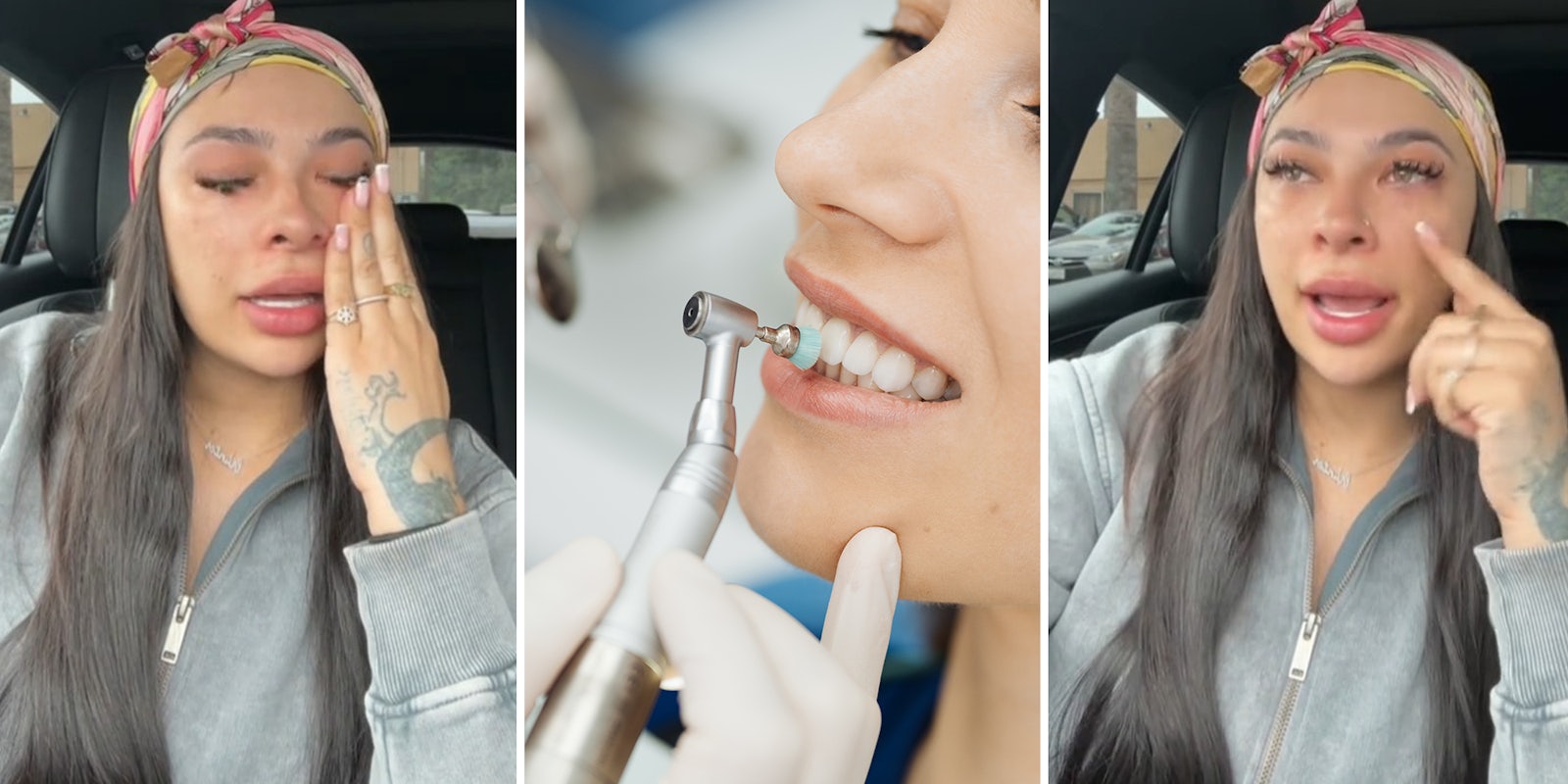 Woman issues dire warning about what can happen when you get veneers
