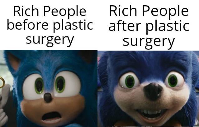 sonic before and after with caption 'rich people before and after plastic surgery'