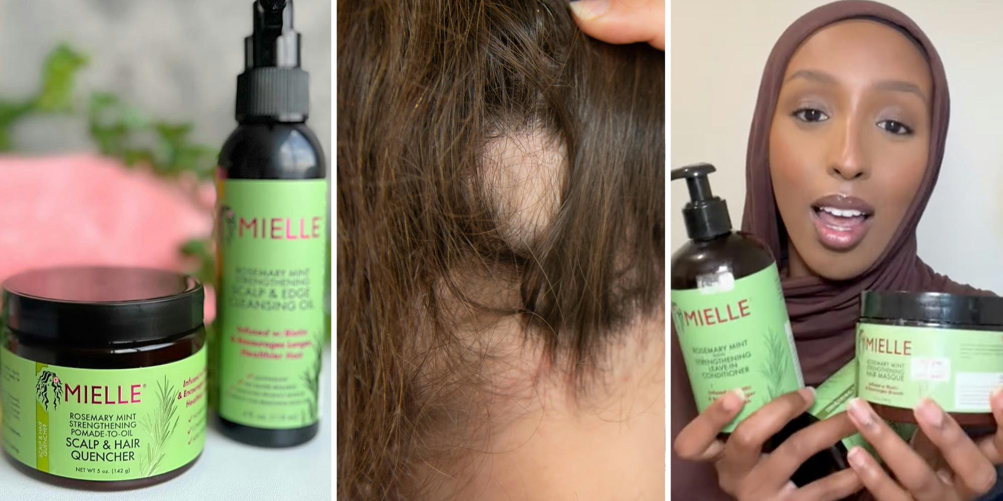 Mielle Organics products(l), Back of scalp with hair loss(c), Woman talking while holding products(r)