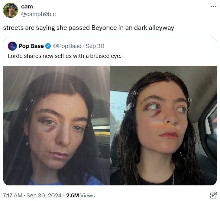 Beyonce kidnapped me meme responding to photos of Lorde with a bruised eye.