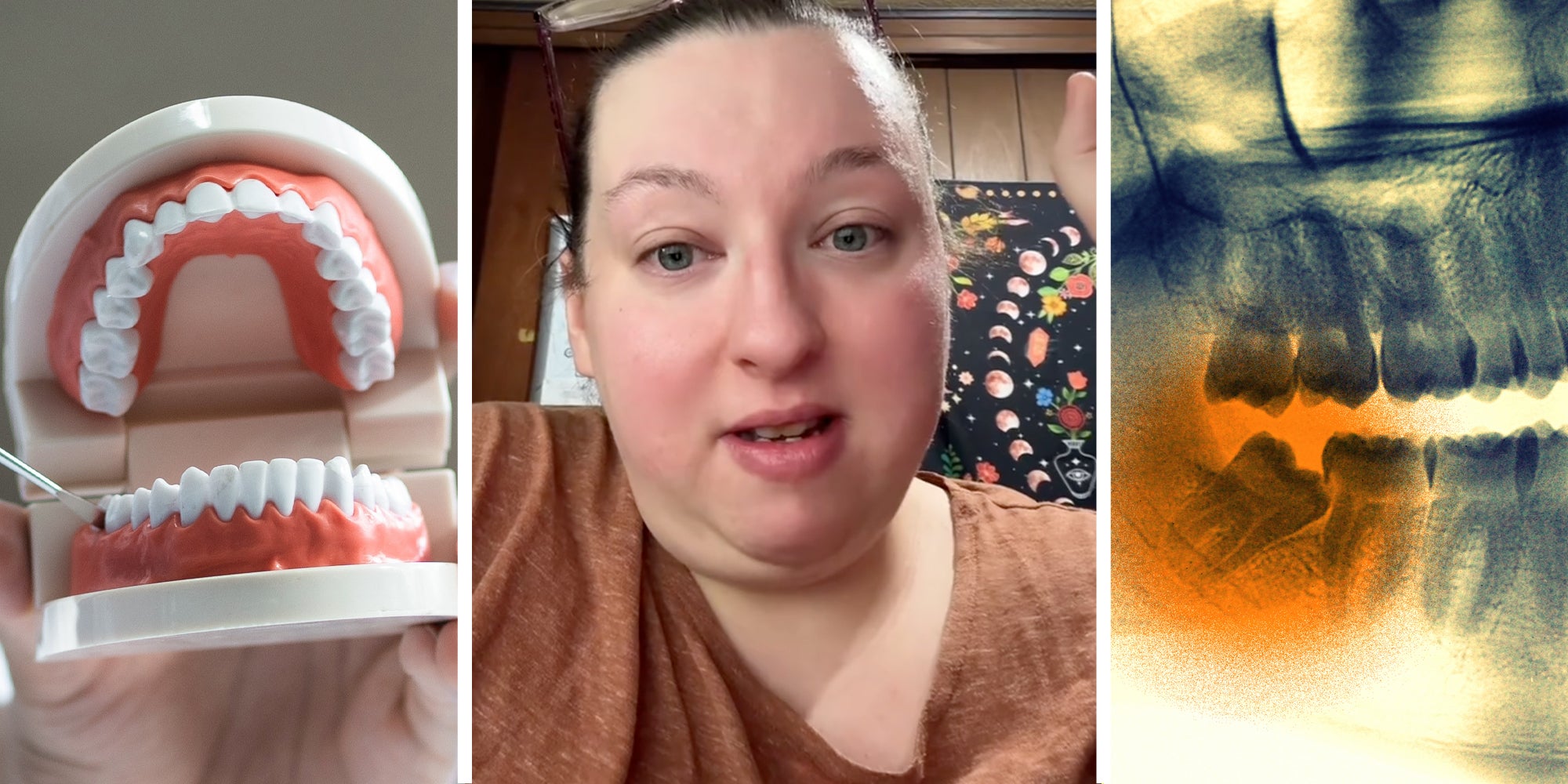 Dental model(l), Woman talking(c), Teeth x-ray(r)